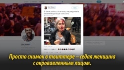 Простые люди, ставшие образом протеста. Главные фото референдума в Каталонии Простые люди, ставшие образом протеста. Главные фото референдума в Каталонии